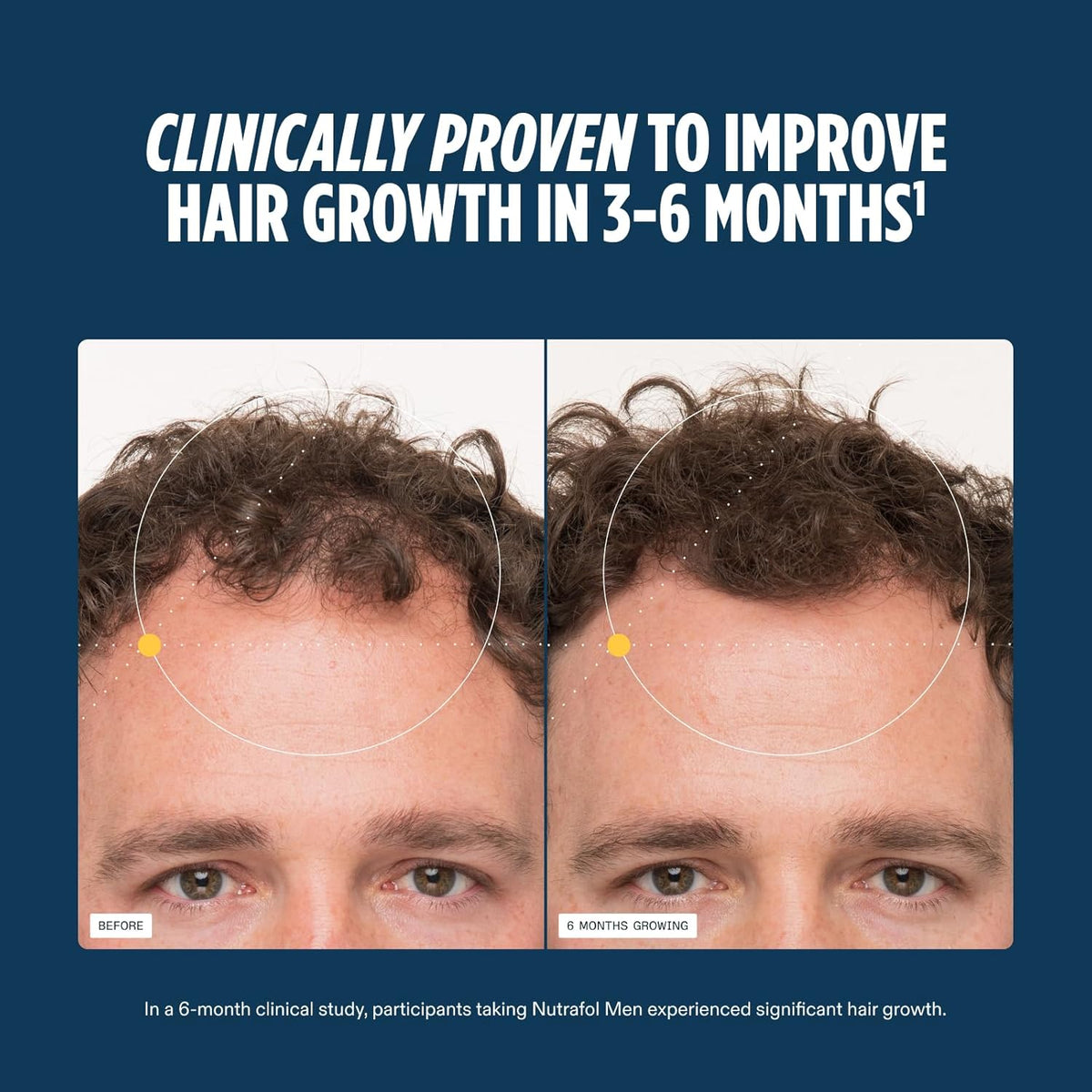 Nutrafol Men Hair Growth Supplements, Ages 18-49